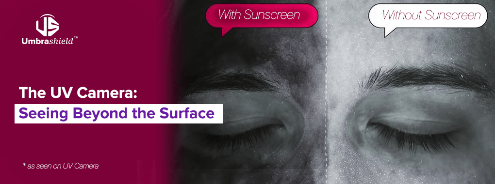 UV Camera