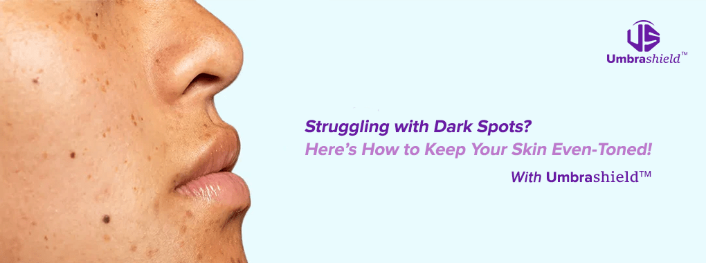 Dark spots, uneven skin tone, UV protection clothing, sun protection jacket, UV mirror, hyperpigmentation prevention