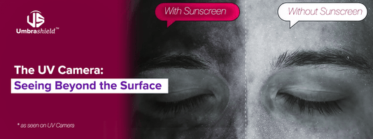 uv camera